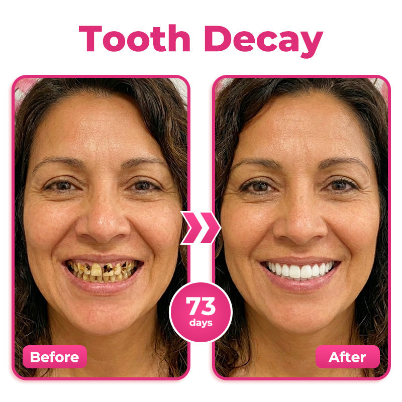 🦷 Natravor® Thismile NH-10 Toothpaste Serum for Enamel & Gum Care – Advanced Therapy
