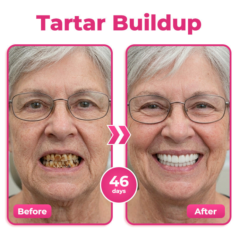 🦷 Natravor® Thismile NH-10 Toothpaste Serum for Enamel & Gum Care – Advanced Therapy