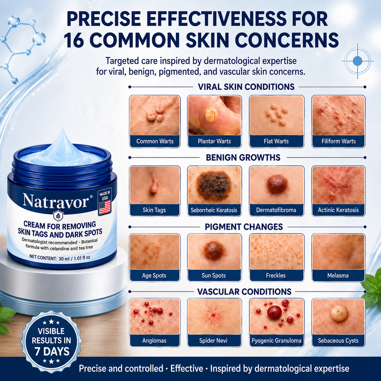 Natravor® 7-𝐃𝐚𝐲 𝐒𝐤𝐢𝐧 𝐓𝐚𝐠 & 𝐒𝐩𝐨𝐭 𝐄𝐫𝐚𝐬𝐞𝐫 𝐂𝐫𝐞𝐚𝐦 (Zero Pain, Zero 𝐒𝐜𝐚𝐫𝐬 Formula) 🎈