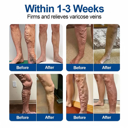 🔥🇺🇸👨‍⚕️✅Natravor® VeinEase Microneedle Care Patch⚡Instant Relief, Long-Term Results