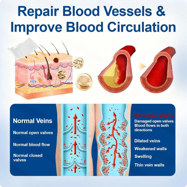 🔥🇺🇸👨‍⚕️✅Natravor® VeinEase Microneedle Care Patch⚡Instant Relief, Long-Term Results